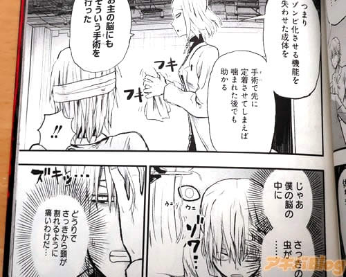 「ゾンビ化させる機能を失わせた成体を手術で先に定着させてしまえば、噛まれた後でも助かる。お主の脳にもそういう手術を行った」