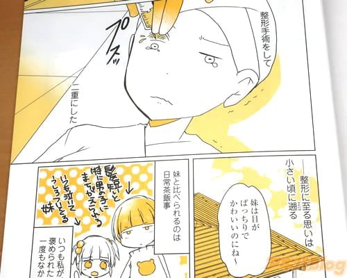 「(私は5年前、整形手術をした)」